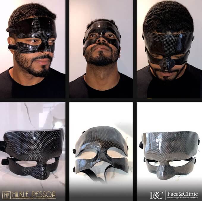 Goleiro Thiago Rodrigues continuará com o protetor facial em 2022